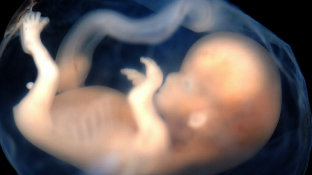 Tradicionalismo – Acte contra el crim de l’avortament el pròxim 25 de març del 2026